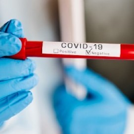 Coronavirus: el Gobierno nacional confirmó 160 muertes y 7.482 nuevos contagios en las últimas 24 hs
