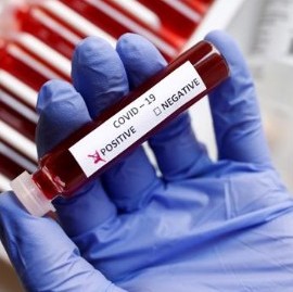 19-10-2020 // Coronavirus: el Gobierno nacional confirmó que se superó el millón de contagios