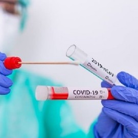 Coronavirus: el Gobierno nacional confirmó 443 muertes y 12969 nuevos contagios en las últimas 24 hs