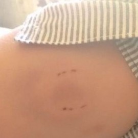 La Plata: el dueño de una casa de comidas, denunciado por golpear y morder salvajemente a una chica