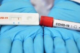 Coronavirus: el Gobierno nacional confirmó 117 muertes y 5.344 nuevos contagios en las últimas 24 hs
