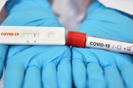 Coronavirus: el Gobierno nacional confirmó 206 muertes y 8.841 nuevos contagios en las últimas 24 hs