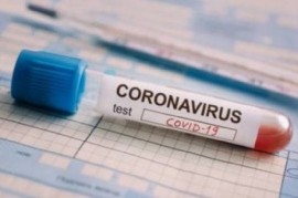 REPORTE DIARIO VESPERTINO NRO 248 | SITUACIÓN DE COVID-19 EN ARGENTINA: 3.624 nuevos casos