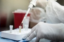 Coronavirus: el Gobierno nacional confirmó 429 muertes y 8.782 nuevos contagios en las últimas 24 hs