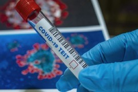 Coronavirus: el Gobierno nacional confirmó 197 muertes y 11.129 nuevos contagios