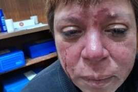 Juicio oral a la dueña del bar de 4 y 53 por brutal agresión a una inspectora
