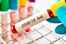 Coronavirus: el Gobierno nacional confirmó 245 muertes y 12026 nuevos contagios en las últimas 24 hs