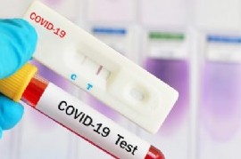 Coronavirus: el Gobierno nacional confirmó 223 muertes y 7.668 nuevos contagios