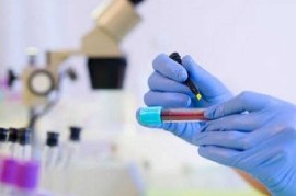 Coronavirus: el Gobierno nacional confirmó 470 muertes y 12027 nuevos contagios en las últimas 24 hs