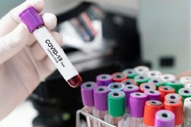 Coronavirus: el Gobierno nacional confirmó 250 muertes y 11905 nuevos contagios en las últimas 24 hs