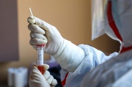 Coronavirus: el Gobierno nacional confirmó 211 muertes y 10104 nuevos contagios en las últimas 24 hs