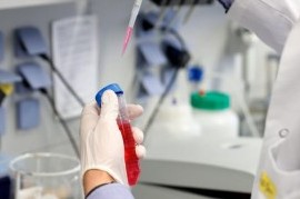 Coronavirus: el Gobierno nacional confirmó 111 muertes y 4.557 nuevos contagios en las últimas 24 hs