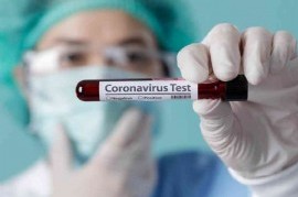 Coronavirus: el Gobierno nacional confirmó 241 muertes y 7.043 nuevos contagios en las últimas 24 hs