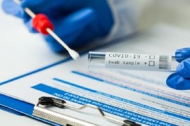 Coronavirus: el Gobierno nacional confirmó 452 muertes y 11.242 nuevos contagios
