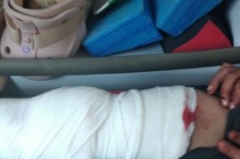 Tres menores robaron en una farmacia céntrica de La Plata y uno de ellos terminó herido e internado