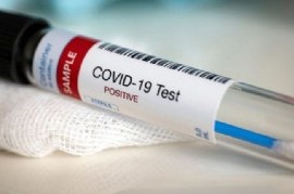 Coronavirus: el Gobierno nacional confirmó 406 muertes y 13477 nuevos contagios en las últimas 24 hs