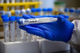 Coronavirus: el Gobierno nacional confirmó 382 muertes y 8.713 nuevos contagios en las últimas 24 hs