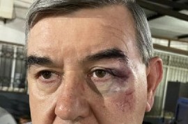 Escándalo en Misiones: agresiones y golpes a un empresario de colectivos por parte de un colega