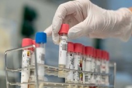 18-10-2020 // Coronavirus: el Gobierno nacional confirmó 161 muertes y 10.561 nuevos contagios