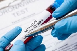 Coronavirus: el Gobierno nacional confirmó 120 muertes y 6.986 nuevos contagios en las últimas 24 hs