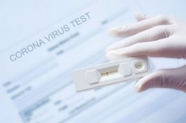 Ante el aumento de contagios e hisopados, la ANMAT autorizó el uso de cuatro autotest de Coronavirus