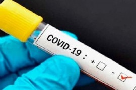 Coronavirus: el Gobierno nacional confirmó 149 muertes y 7.948 nuevos contagios en las últimas 24 hs