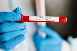 Coronavirus: el Gobierno nacional confirmó 160 muertes y 7.482 nuevos contagios en las últimas 24 hs