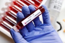 19-10-2020 // Coronavirus: el Gobierno nacional confirmó que se superó el millón de contagios