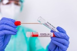 Coronavirus: el Gobierno nacional confirmó 199 muertes y 10933 nuevos contagios en las últimas 24 hs