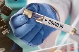 Coronavirus: el Gobierno nacional confirmó 89 muertes y 9.056 nuevos contagios en las últimas 24 hs