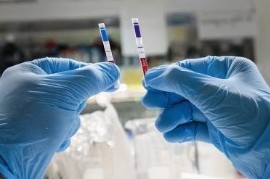 07-12-2020 // Coronavirus: el Gobierno nacional confirmó 118 muertes y 3.119 nuevos contagios