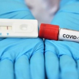 Coronavirus: el Gobierno nacional confirmó 117 muertes y 5.344 nuevos contagios en las últimas 24 hs