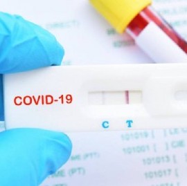 Coronavirus: el Gobierno nacional confirmó 105 muertes y 5.493 nuevos contagios en las últimas 24 hs