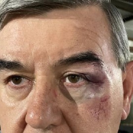 Escándalo en Misiones: agresiones y golpes a un empresario de colectivos por parte de un colega