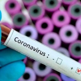 Coronavirus: el Gobierno nacional confirmó 86 muertes y 4.814 nuevos contagios en las últimas 24 hs