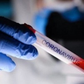 REPORTE DIARIO VESPERTINO Nro 242- SITUACIÓN DE COVID-19 EN ARGENTINA:  3.099 nuevos casos